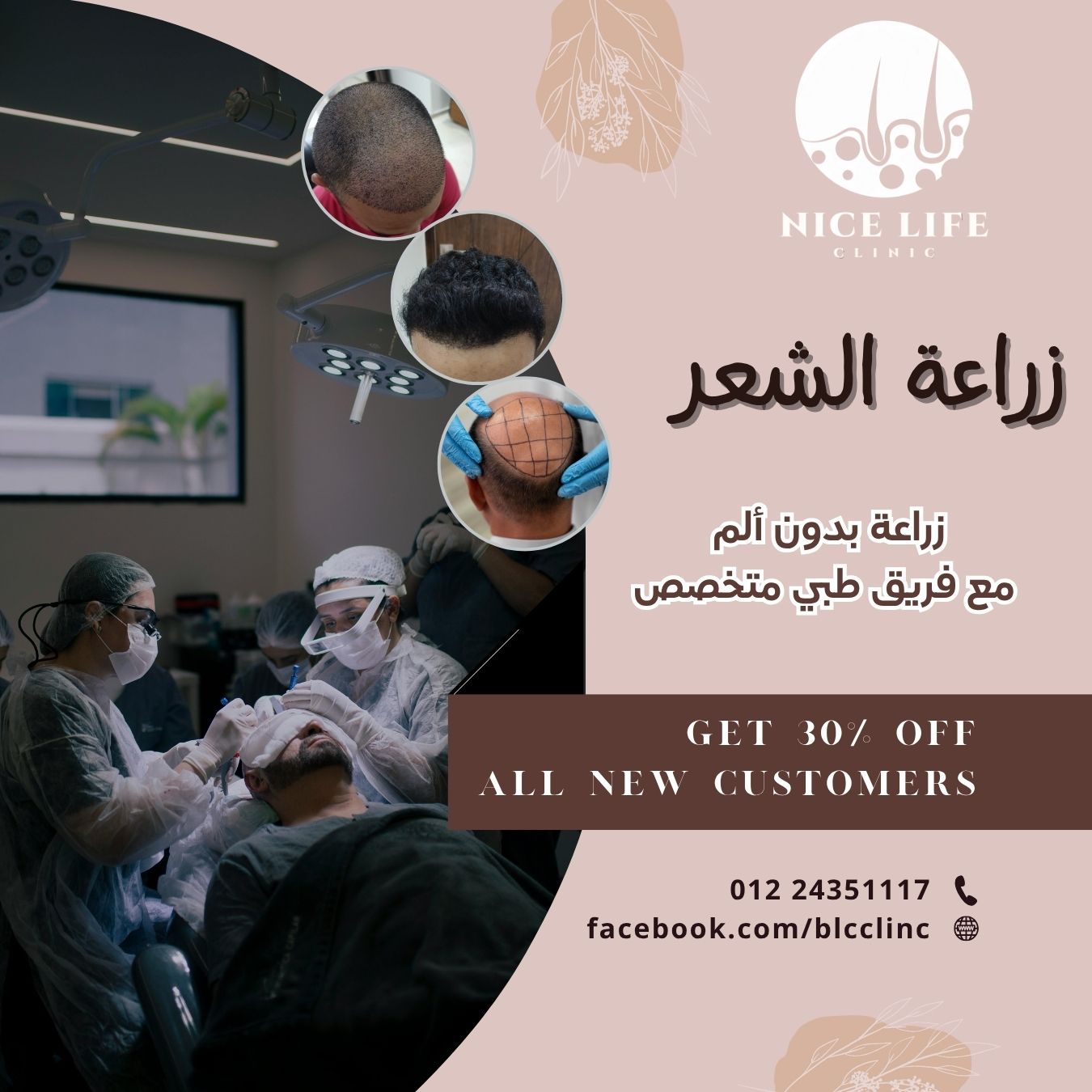 نتيجة عملية زراعة شعر 2