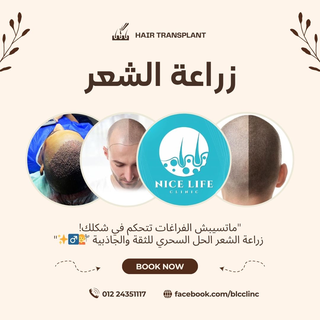نتيجة عملية زراعة شعر 4
